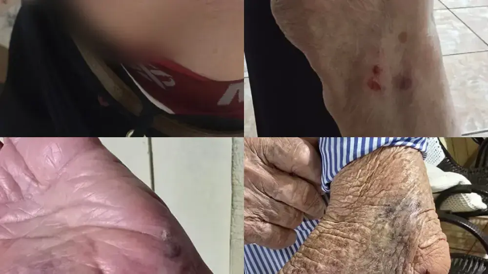 Idoso de 87 anos é derrubado e mordido por cão na Vila Nasser